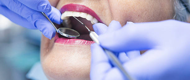 Best Emergency Tooth Extraction in Aurora, MO